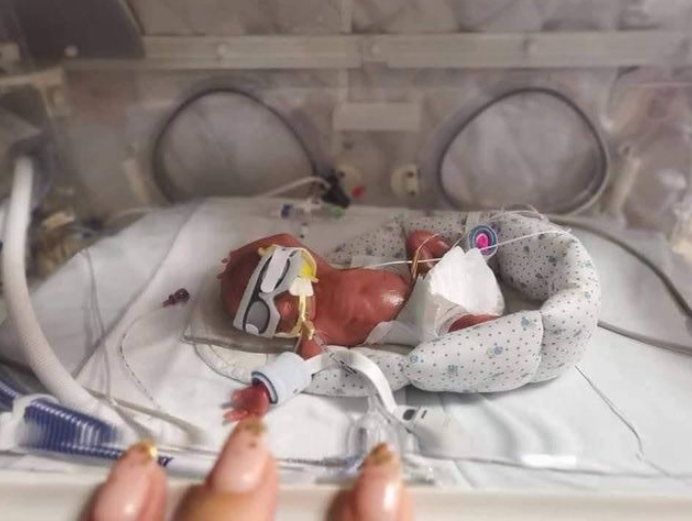 Newly born Bowie in a neocot