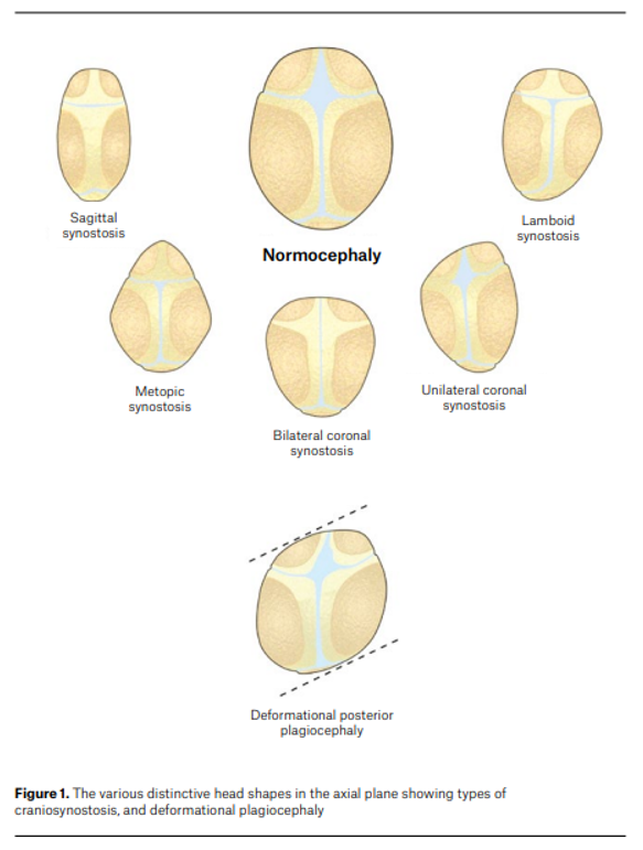 Head shape and size abnormalities - Prereferral management flowchart