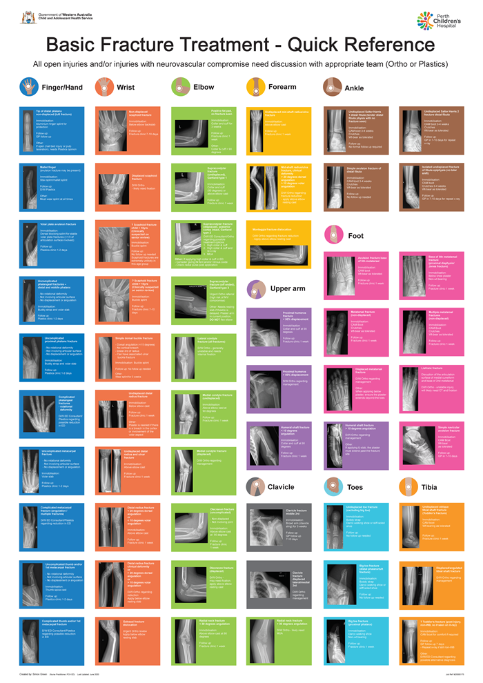 Fractures - Quick reference chart