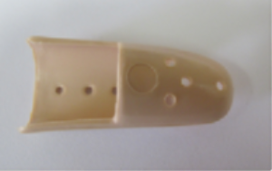 Volar aspect of Stax finger splint. 