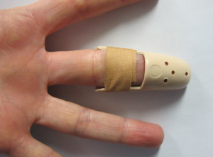 Stax splint volar aspect fixed with adhesive tape