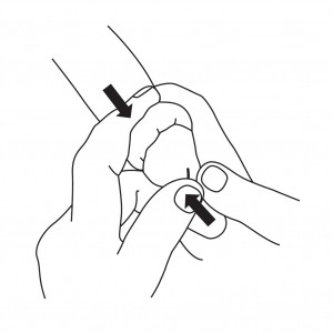 Technique for manual reduction of the foreskin