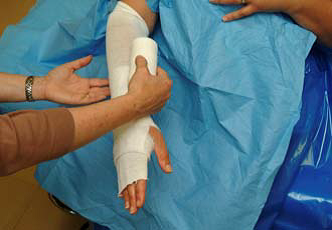 Plaster application - applying padding (Webril)