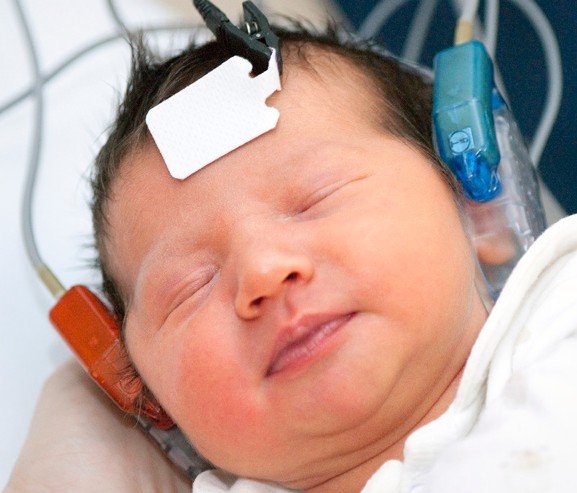 Baby undergoing a hearing test